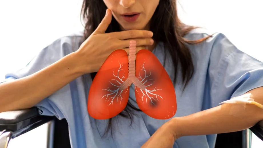 Boala cauzată de poluare care bagă mii de români în spital. Medic: „1 din 4 pacienți cu această afecțiune dezvoltă cancer pulmonar”