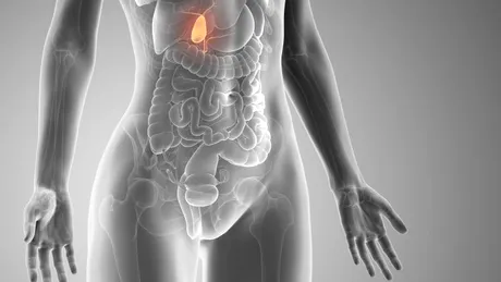 Cancerul veziculei (vezicii) biliare: cauze, simptome, tratament