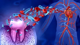 Afecțiunile cardiovasculare pot grăbi pierderea dinților! Dr. Ionuț Leahu: „Nu începem cu implantul dentar, începem cu pacientul”