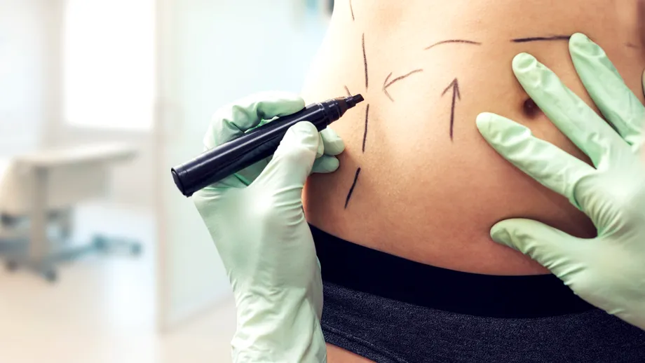 Un medic estetician din Constanța este anchetat pentru că a mutilat mai multe paciente. Tinerele au rămas cu sechele pe viață