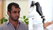 PREMIERĂ. Cercetătorii de la Universitatea Politehnica din București au creat un picior bionic controlat cu puterea gândului