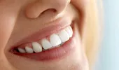 Sunteţi candidatul ideal pentru implant dentar?