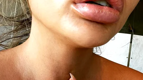 Chrissy Teigen, eșec cu acidul hialuronic? Ce a pățit modelul