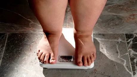 Cum arată acum tânăra care la vârsta de 7 ani cântărea 220 de kg. Ani la rând a consumat 10.000 de calorii zilnic / VIDEO