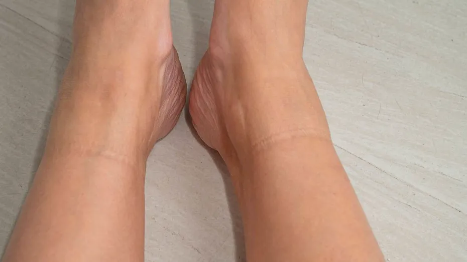 Dacă ai această linie pe picior suferi de boli cardiovasculare. Semne care trec neobservate, dar indică probleme serioase de sănătate