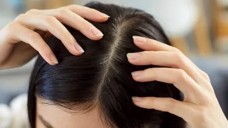 De ce îți cade părul: cauze mai puțin evidente pe care le ignori