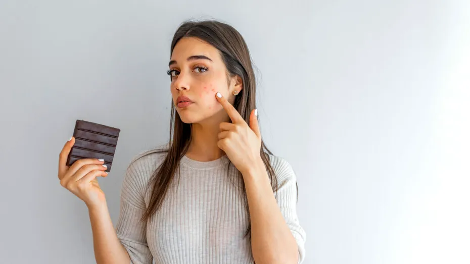 Evită aceste alimente dacă vrei o piele sănătoasă