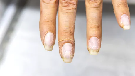 Uleiul din bucătărie care îți tratează cuticulele uscate. Timp de 5-10 minute trebuie să îl lași să acționeze