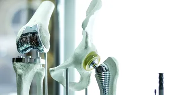 Protezarea șoldului prin procedură minim invazivă, explicată în detaliu de medicul ortoped