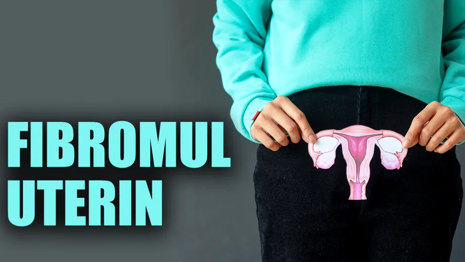 Tot ce trebuie să știi despre fibromul uterin