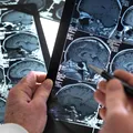 Povestea sfâșietoare a unui bărbat care își vede soția schimbându-se în fiecare zi din cauza unei boli: „Mi-e dor de partenera mea, de prietena mea”