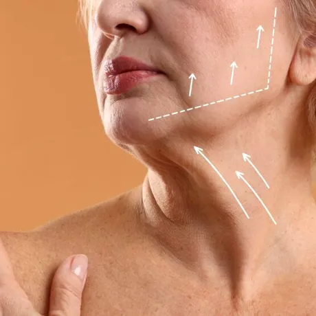 Liftingul cervical: când gâtul are nevoie de chirurgie și nu de încă un tratament estetic