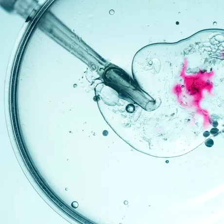 Încep înscrierile în Programul FIV 2025. Cât oferă statul român pentru fertilizare in vitro?