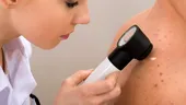 Medic dermatolog - cum decurge un consult de rutină