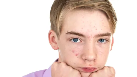 Pubertatea întârziată sau incompletă la sexul masculin: cauze, simptome, tratament