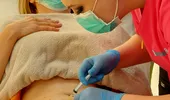 Lipoza injectabilă, alternativa non-invazivă a liposucției