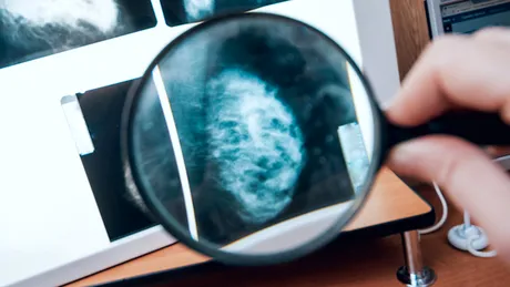 Dr. Mihaela Sebeni: importanţa mamografiei şi ecografiei în depistarea cancerului mamar VIDEO