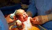 Cum arată o naştere prin cezariană! VIDEO LIVE