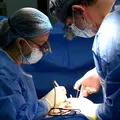 Boala frecventă, care poate da complicații severe. Varicele nu sunt doar o problemă de natură estetică