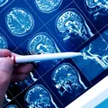 Cum se deformează creierul atunci când muncești prea mult. Descoperirea făcută de cercetători