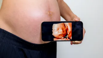 Momentul uimitor din uter despre care se cunosc puține lucruri. Cum se pregătesc bebelușii pentru prima întâlnire cu lumea