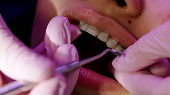 (P) 5 motive pentru care merită să alegi un aparat dentar din safir