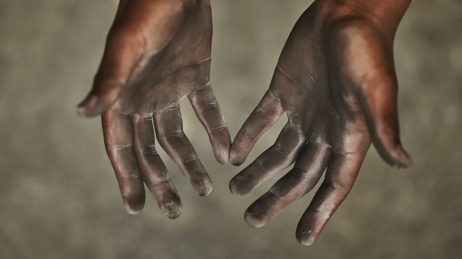 STUDIU: Pompierii au un risc crescut de melanom din cauza expunerii din timpul intervențiilor