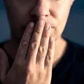 Semnul alarmant care apare în jurul gurii când ai deficit de vitamina B12