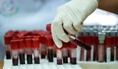 De ce nu este recomandat să îți faci analizele imediat după vacanță. Explicațiile unui medic de laborator