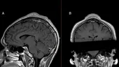 Când au văzut radiografia asta, medicilor nu le-a venit să creadă. Ce a păţit un bărbat după ce s-a învârtit în cap