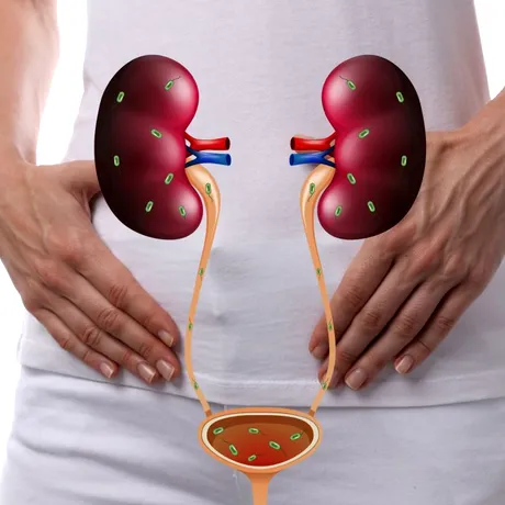 Infecțiile urinare netratate îți pot distruge rinichii. Cum le previi și tratezi
