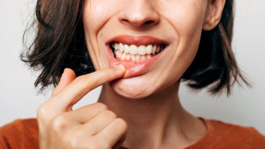 Trend pe TikTok: tinerii își zgârie dinții și gingiile ca să scape de tartru acasă. De ce este periculos!