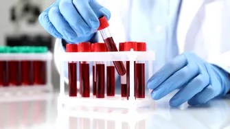 Boala Crohn ar putea fi depistată cu 10 ani înainte de diagnostic. Ce a dezvăluit un studiu recent