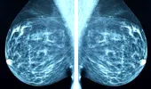 Ecografie, mamografie sau RMN pentru depistarea cancerului de sân?