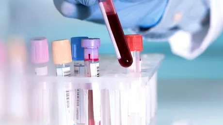 Un nou test de sânge ar putea depista peste 50 de tipuri de cancer