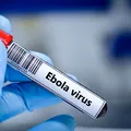 Un nou vaccin experimental împotriva Ebola, dezvoltat la Oxford, ar putea intra în teste în următoarele luni