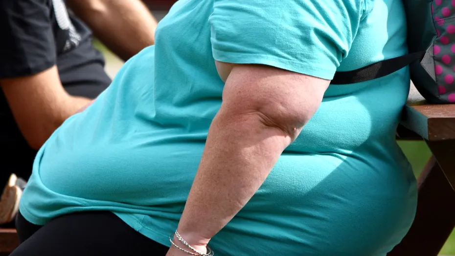 Nu-ți scurta viața lăsând obezitatea netratată! Ce poți face pentru a reduce semnificativ riscul de a dezvolta cancer de colon