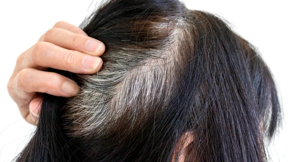 Ce să mănânci ca să întârzii albirea părului