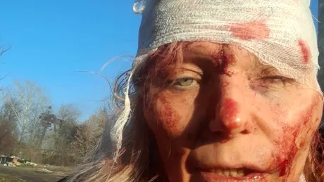 Olena Kurilo, femeia devenită imaginea-simbol a războiului dintre Rusia și Ucraina, în urma unui bombardament