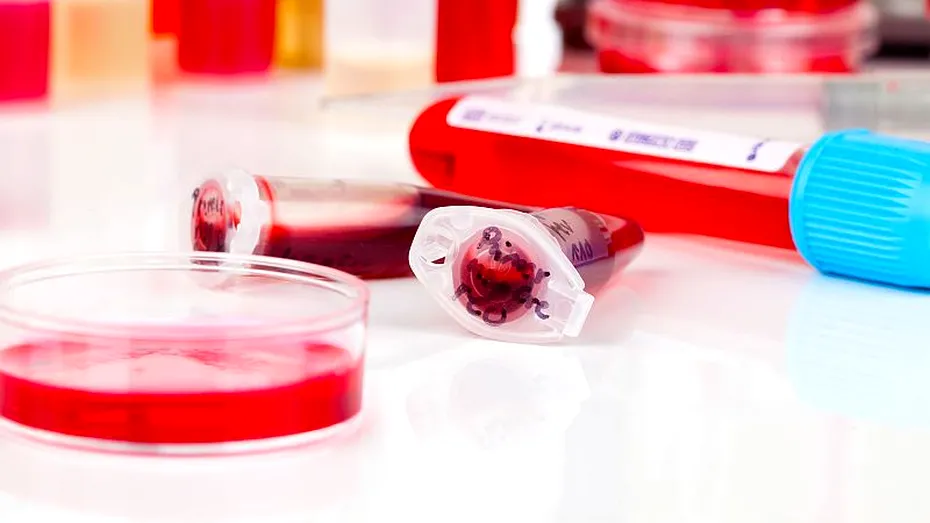 Transformarea celulelor stem în celule sangvine, un posibil tratament pentru leucemie