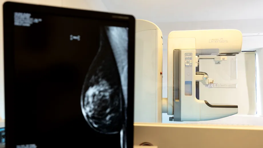 Cum se stabilește corect diagnosticul cancerului de sân?