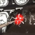 O moleculă din creier ar putea alimenta boala Alzheimer. Studiile au evidențiat un „comutator” al inflamației
