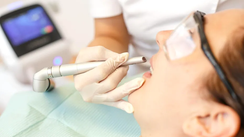 (P) Albirea dentară cu laser Dioda: alternativa în cabinet la metodele clasice cu gutiere