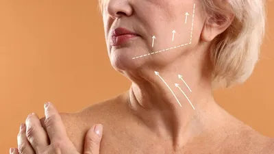 Liftingul cervical: când gâtul are nevoie de chirurgie și nu de încă un tratament estetic