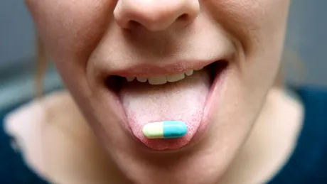Medicamente care îți fac limba maronie. Ce spune culoarea neobișnuită a limbii despre sănătatea ta
