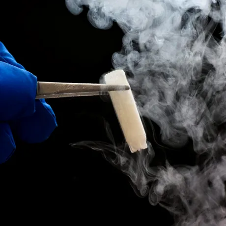 5 motive să îți congelezi ovocitele dacă ai sub 35 de ani