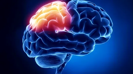 Glioblastomul: simptome, tratament