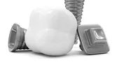 Implanturi dentare ieftine vs. implanturi scumpe. Iată 6 elemente care fac diferenţa!