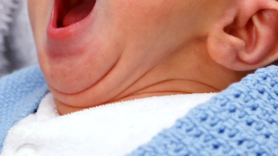 Antiacidele şi de antibioticele administrate sugarilor pot duce la apariţia alergiilor