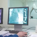 (P) Când ajungi la coronarografie: semnele care arată că nu mai este suficient doar un control de rutină